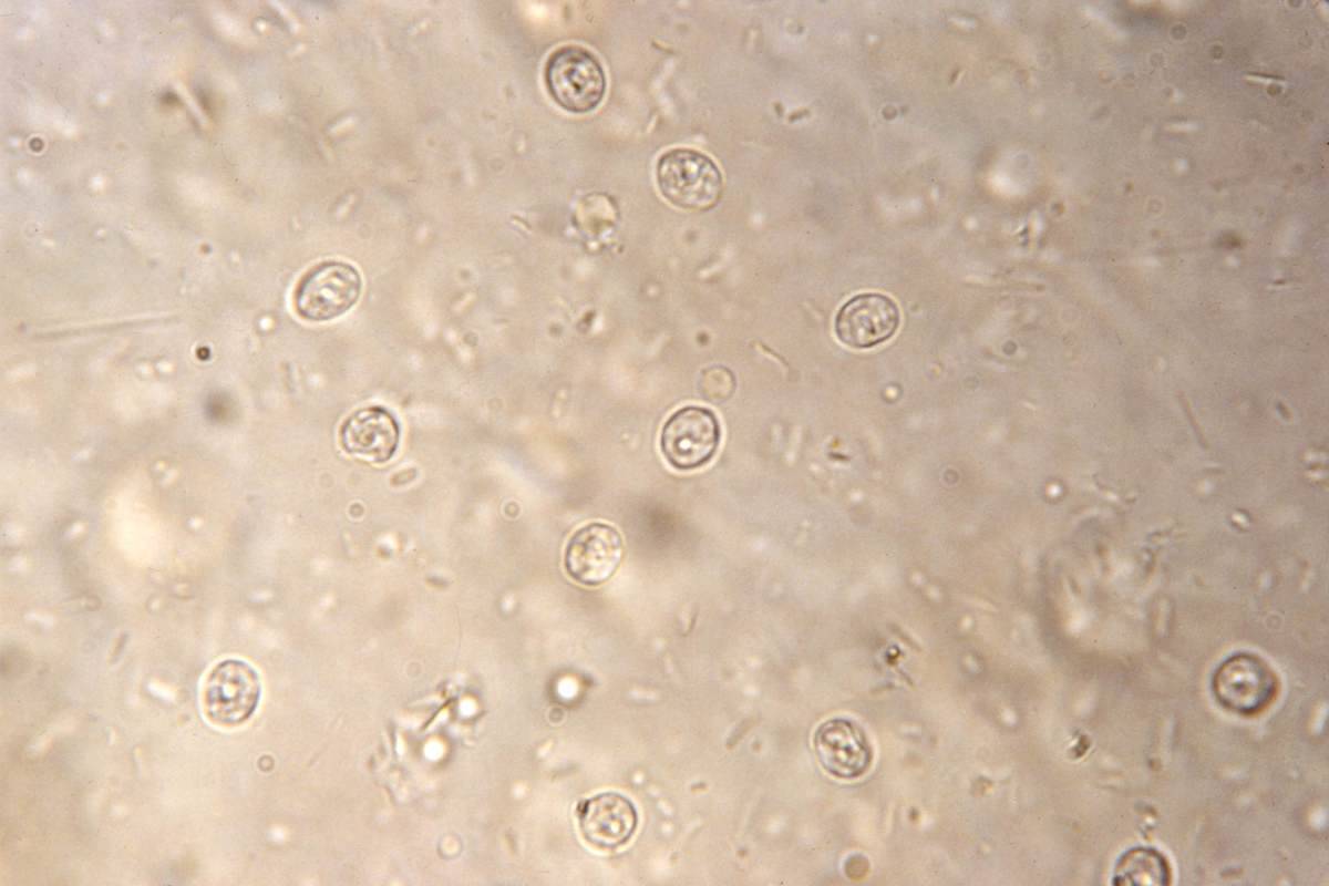 A microscopic image of cryptosporidiosis in a stool sample. (Pixnio image)