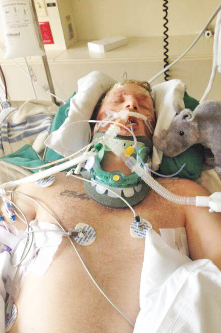 Ryan Jones in intensive care at Vancouver General Hospital shortly after a collision in Fort St. John May 20, 2016 left him for all intents and purposes dead. (Submitted photo)