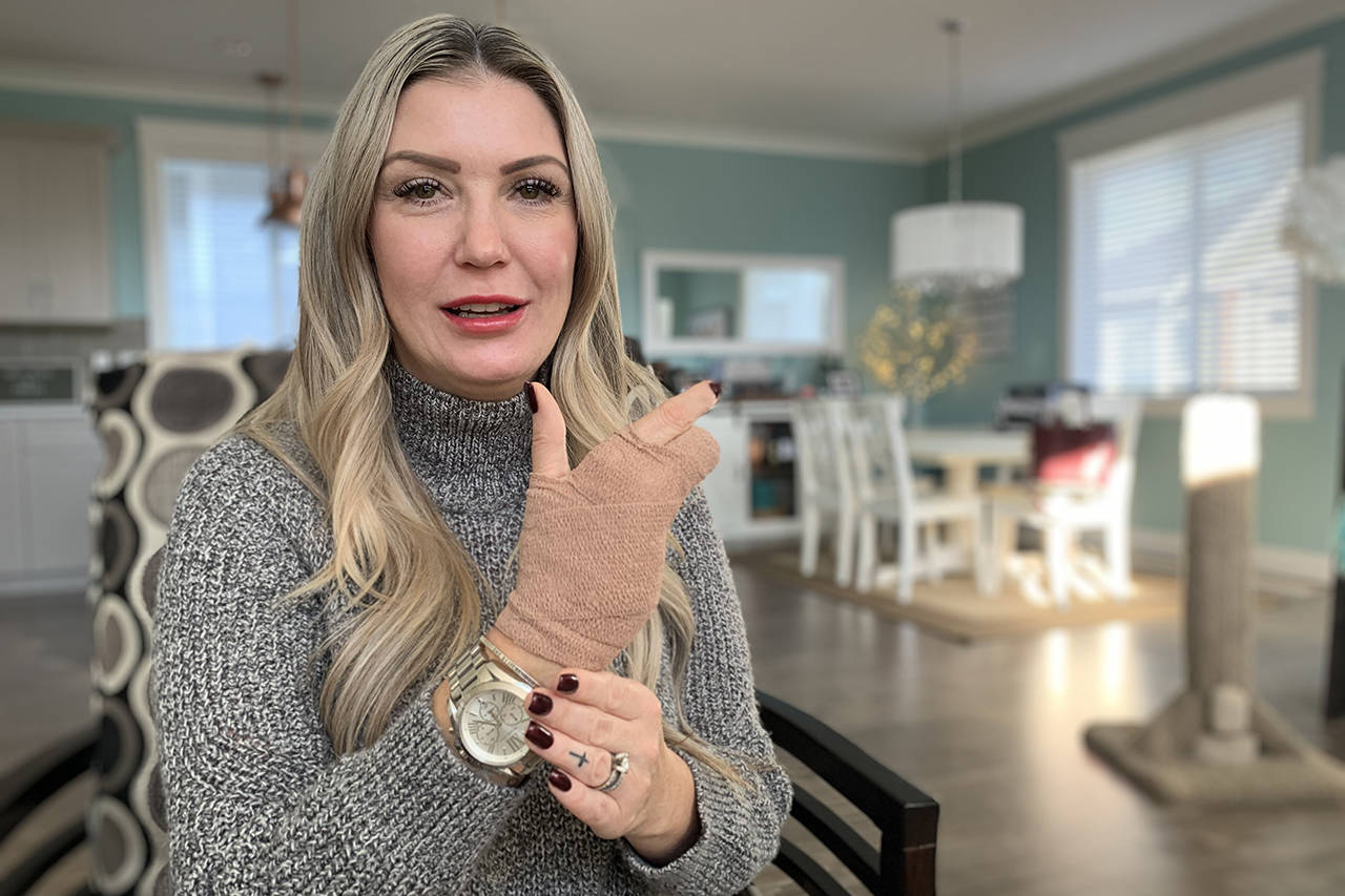 Chilliwack woman struck by train while trying to save man has partial hand amputation