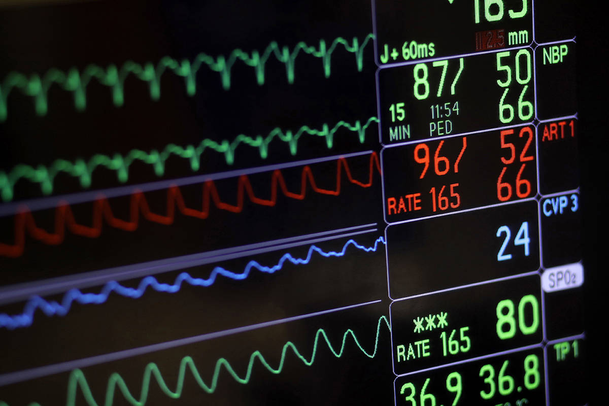 A screen displays a patient’s vital signs during open heart surgery at the University of Maryland Medical Center in Baltimore on Nov. 28, 2016. A new medical review of the existing research into women’s cardiovascular disease has uncovered what the authors call a “stunning” lack of information about how women are affected by the disease. THE CANADIAN PRESS/AP, Patrick Semansky