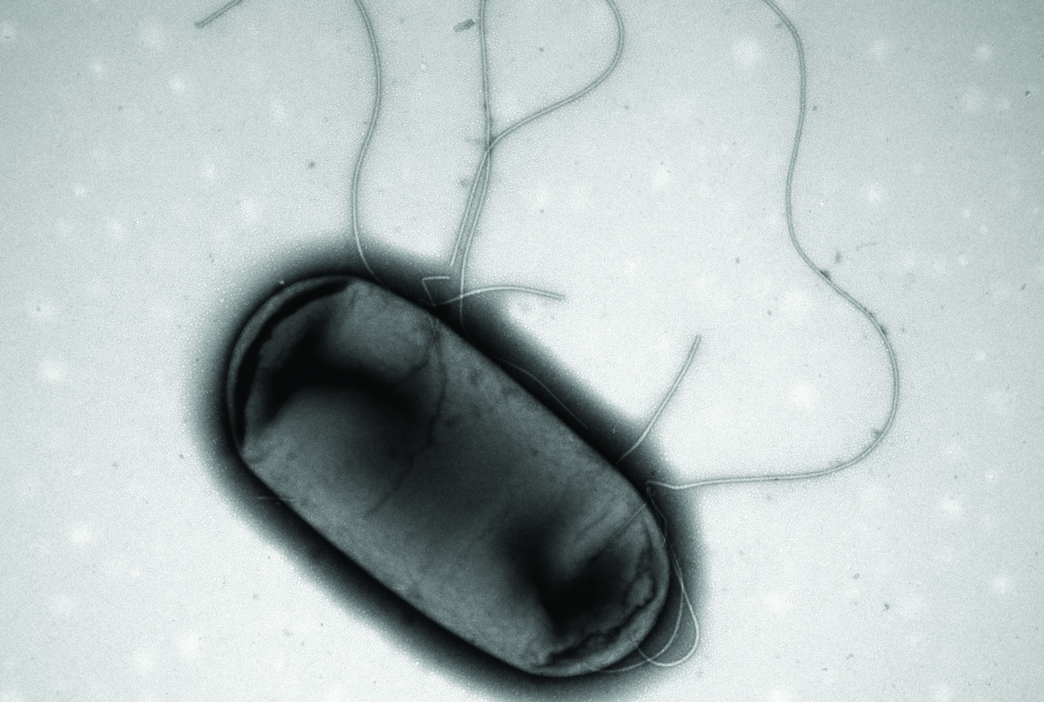 Electron micrograph image of E.coli is shown in a handout photo. MCR-1, a gene that makes bacteria resistant to the killing effects of antibiotics, has been detected in stored samples of E. coli collected in 2010 in Canada. Now scientists are wondering if the superbug gene had made its way into Canada even earlier - and just what that could mean. (THE CANADIAN PRESS/HO-Brian Coombes Laboratory, McMaster University)