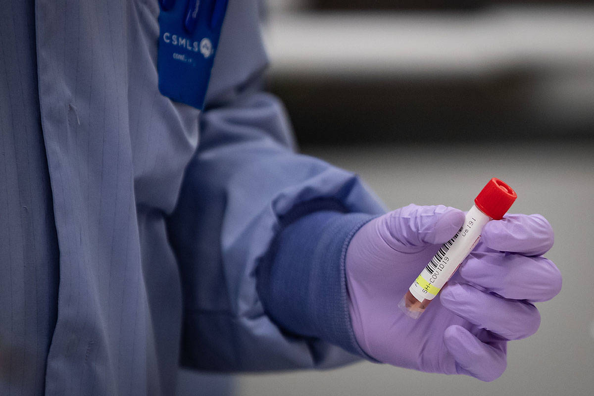 Isaac Muttiah, a laboratory technical assistant at LifeLabs, handles a specimen to be tested for COVID-19 after scanning its barcode upon receipt at the company’s lab, in Surrey, B.C., on Thursday, March 26, 2020. LifeLabs is Canada’s largest private provider of diagnostic testing for health care. THE CANADIAN PRESS/Darryl Dyck