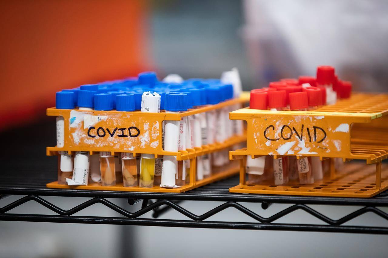 Specimens to be tested for COVID-19 are seen at LifeLabs after being logged upon receipt at the company’s lab, in Surrey, B.C., on Thursday, March 26, 2020. The doctor overseeing Canada’s COVID-19 antibody research says we should get the first glimpse of how many Canadians may already have had COVID-19 by the middle of this month. THE CANADIAN PRESS/Darryl Dyck