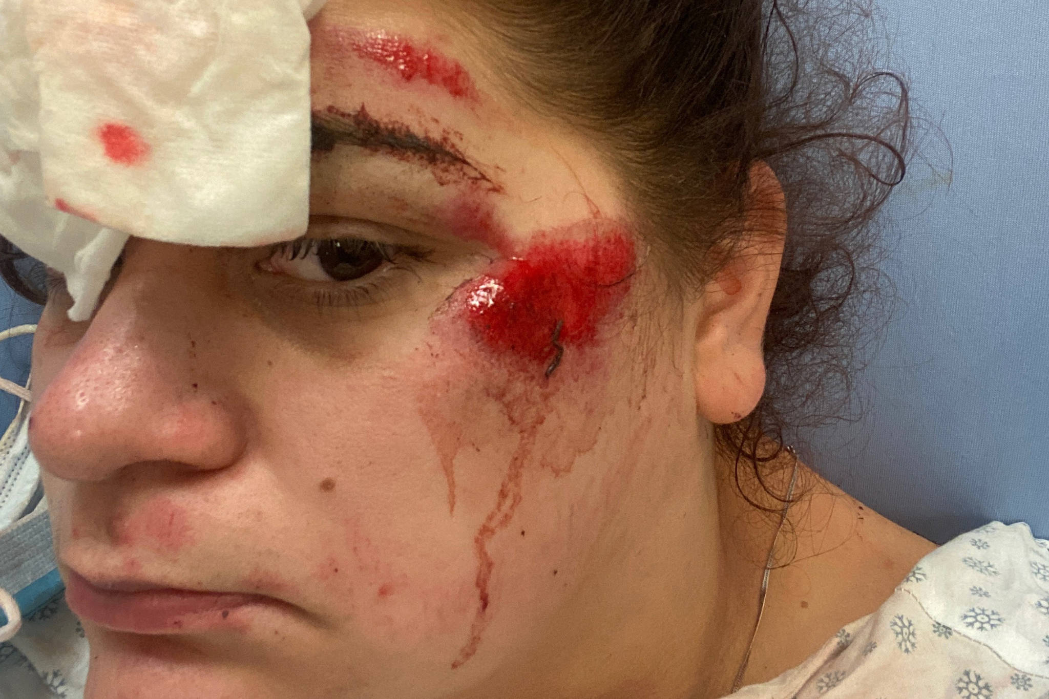 Sophia Koehler on June 23, 2020 at Chilliwack General Hospital after she was apprehended by Mounties after a mental health wellness check. An RCMP spokesperson said Koehler did not co-operate with police, something she denies. (Submitted to The Chilliwack Progress)