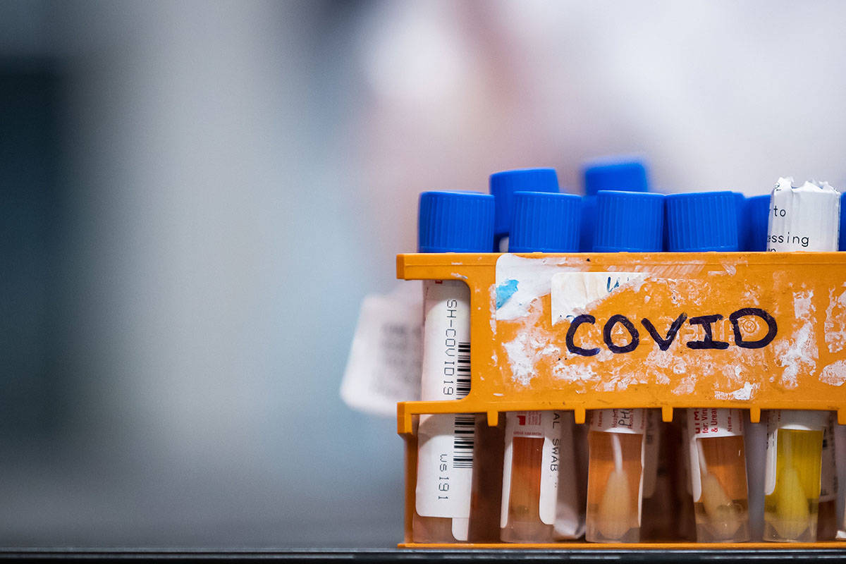 FILE – Specimens to be tested for COVID-19 are seen in Surrey, B.C., on Thursday, March 26, 2020. THE CANADIAN PRESS/Darryl Dyck