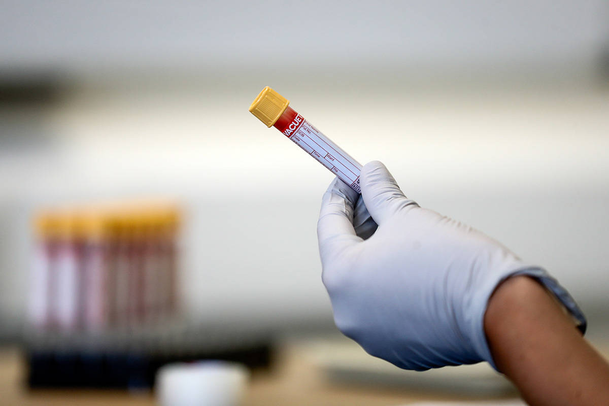 FILE – A paramedic holds a test tube containing a blood sample during an antibody testing program at the Hollymore Ambulance Hub, in Birmingham, England, on Friday, June 5, 2020. (Simon Dawson/Pool via AP)