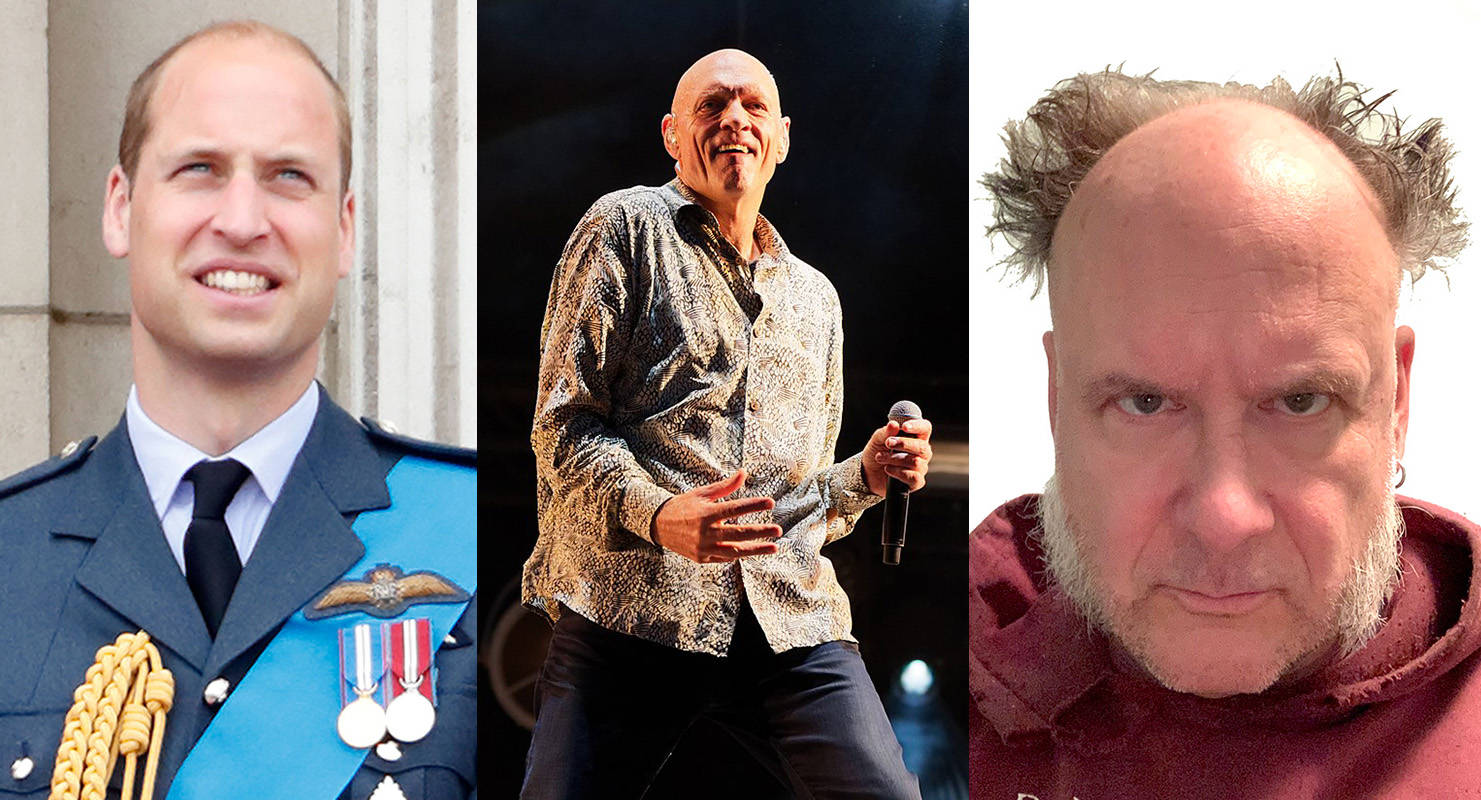 Left to right: Prince William of the House of Windsor — the sexiest bald man in the world, apparently; Peter Garrett, lead singer of Midnight Oil (photo courtesy Thesupermat); Another random bald guy, angry he didn’t make the top 100.