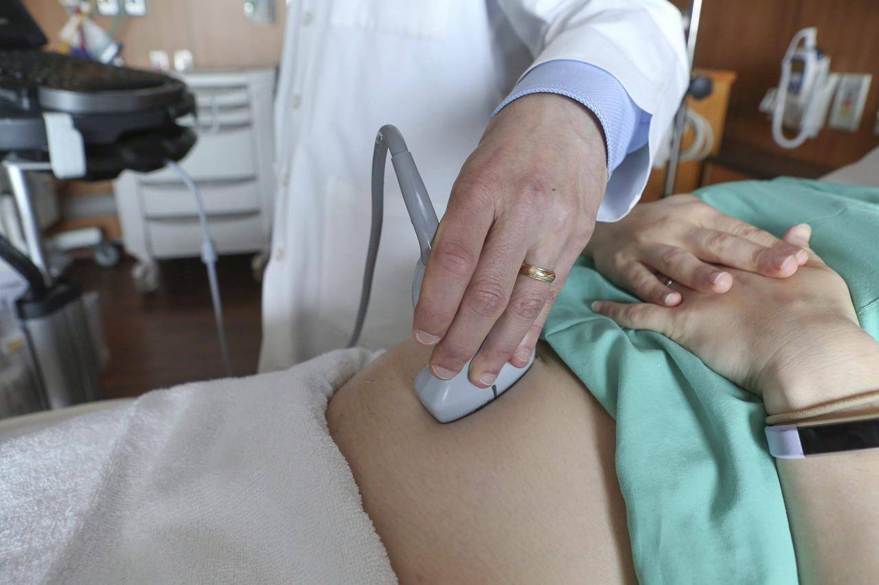 A doctor performs an ultrasound scan on a pregnant woman at a hospital in Chicago on Aug. 7, 2018. THE CANADIAN PRESS/AP-Teresa Crawford