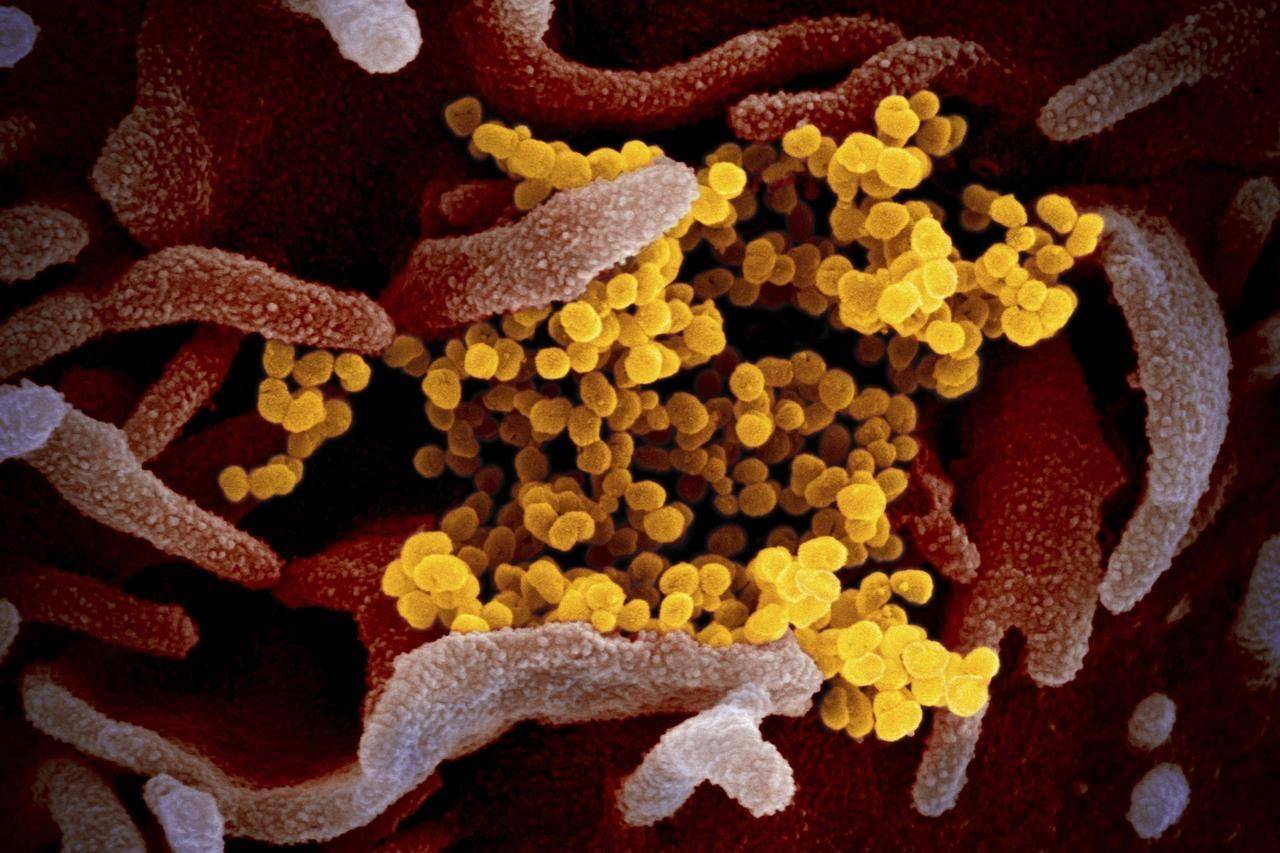 This undated electron microscope image made available by the U.S. National Institutes of Health in February 2020 shows the Novel Coronavirus SARS-CoV-2, yellow, emerging from the surface of cells, pink, cultured in the lab. Also known as 2019-nCoV, the virus causes COVID-19. Public Safety Canada says it has approved a request for help from the Northwest Territories as the territory deals with a surge in COVID-19 cases. THE CANADIAN PRESS/NIAID-RML via AP
