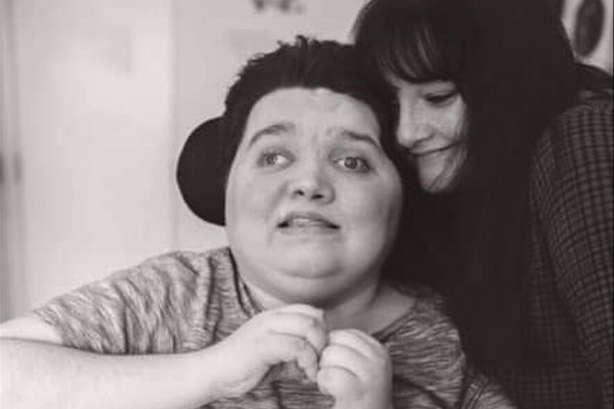 Jessie Simpson was left with life-altering injuries after being attacked with a metal baseball bat on June 19, 2016. (Sue Simpson/Facebook photo)