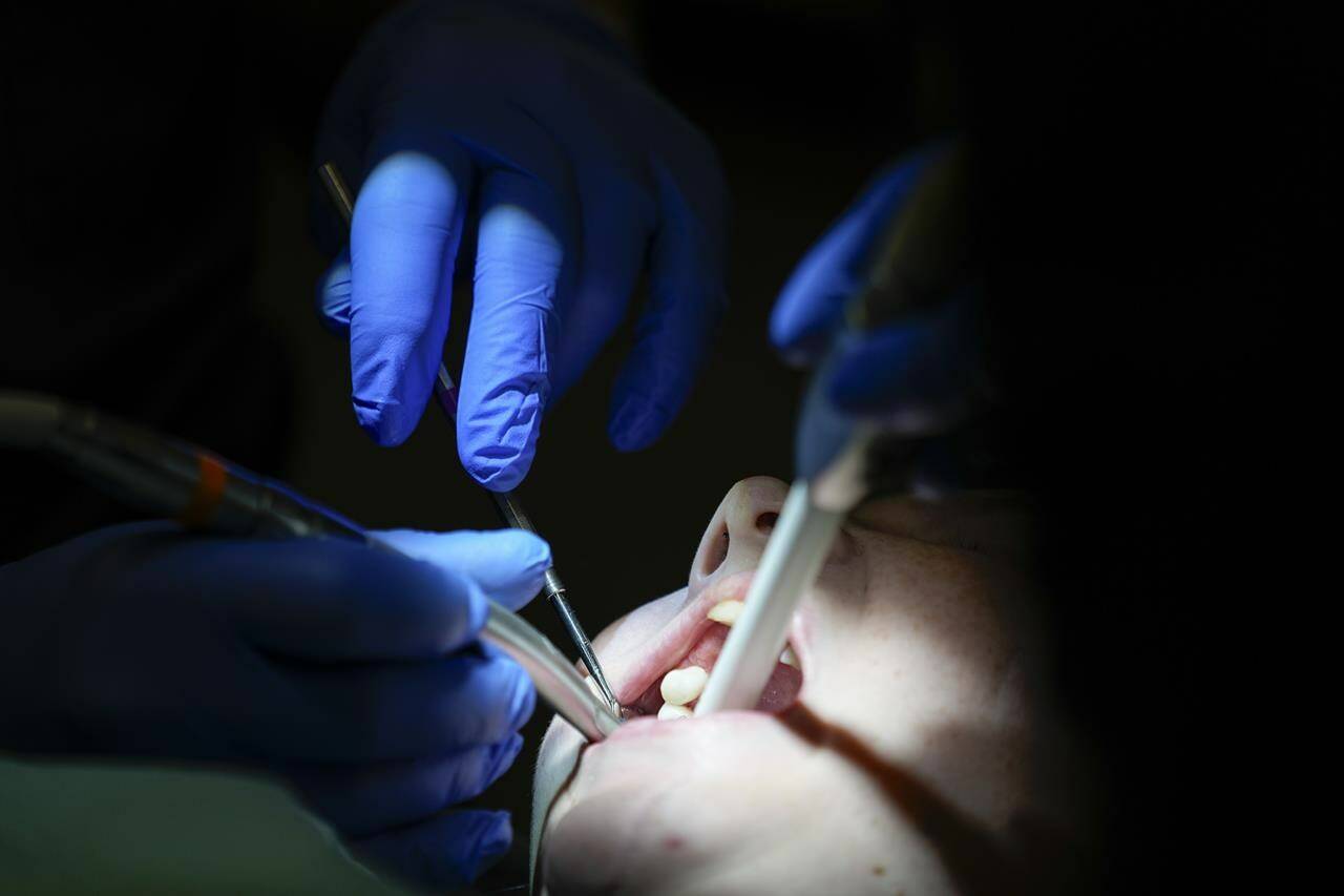 Canadian dentists are demanding details on the government’s soon-to-be announced federal dental insurance plan and how the government pans to preserve existing provincial and private coverage. A dentist works on a patient in Nashville, Tenn during a clinic visit on Thursday, Sept. 7, 2023.THE CANADIAN PRESS/AP-George Walker IV
