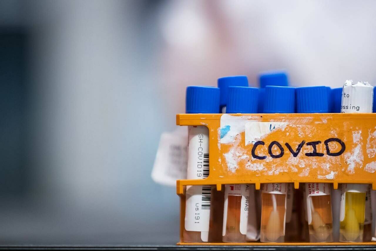 Specimens to be tested for COVID-19 are seen at LifeLabs after being logged upon receipt at the company’s lab, in Surrey, B.C., on Thursday, March 26, 2020. THE CANADIAN PRESS/Darryl Dyck